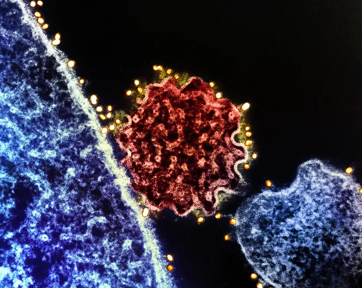 Vírus Nipah está a preocupar a Ásia: como se transmite e quais os sintomas?